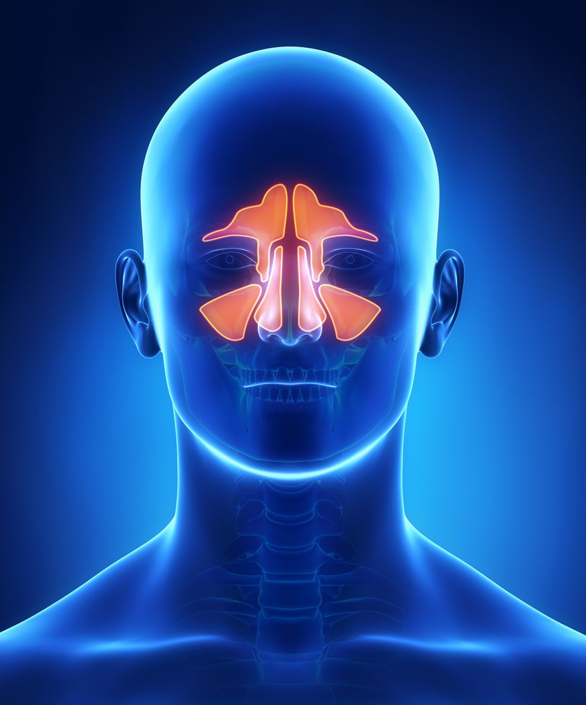 Sobre La Sinusitis La Cl Nica De Rinosinusitis Llcsan Juan Pr Dr