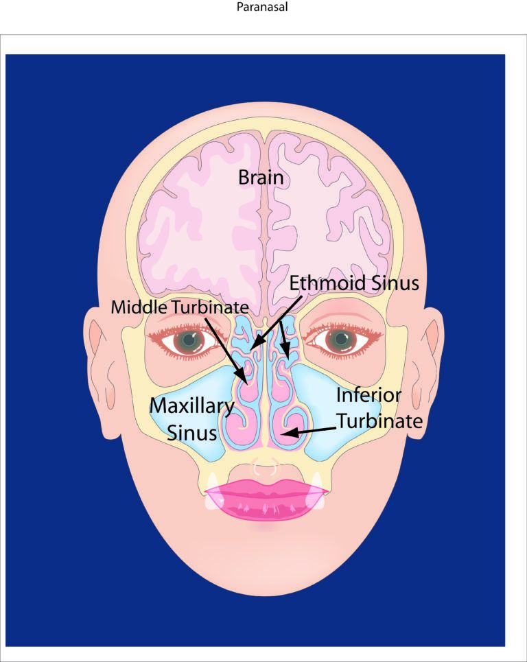 About Your Sinus Nasal Passages La Cl Nica De Rinosinusitis Llcsan Juan Pr Dr Luis Tarrats