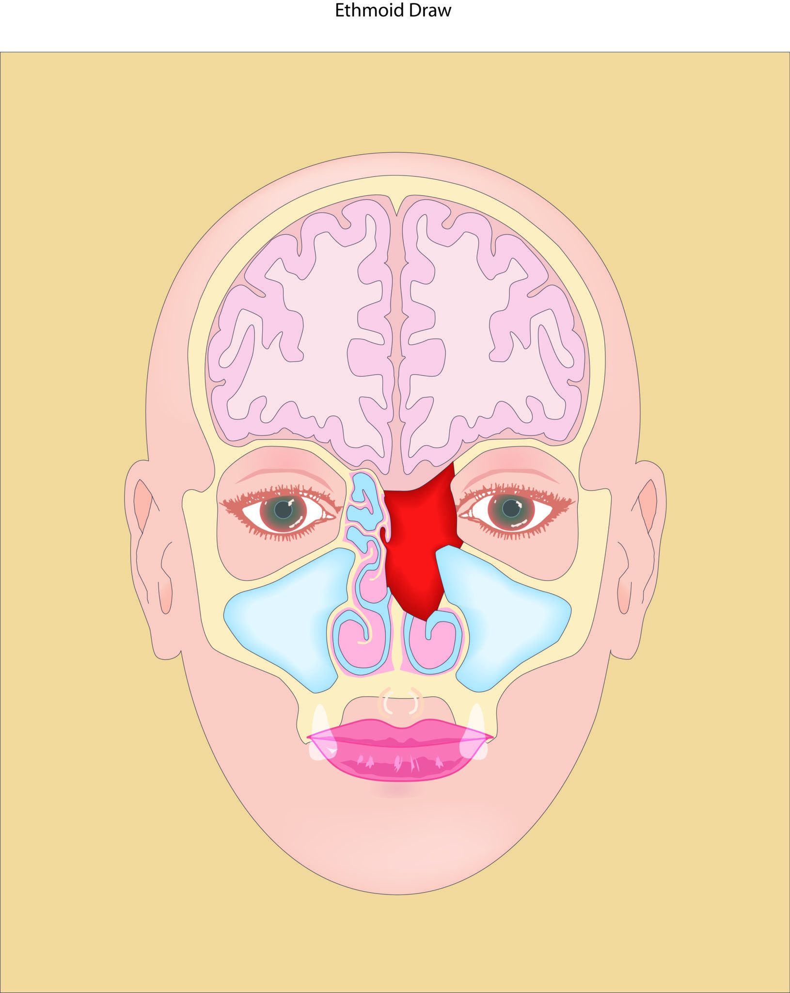 nasal sinus cancer